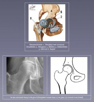 The healthy hip joint